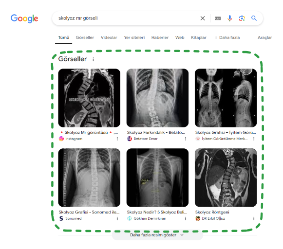 SERP Özellikleri: Görsel Sonuçlar