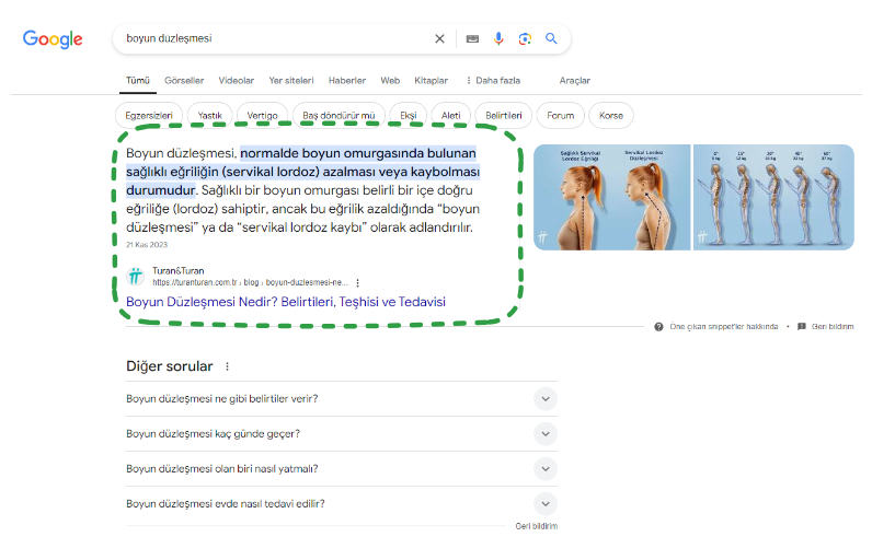 SERP Özellikleri: Öne çıkan snippet'ler