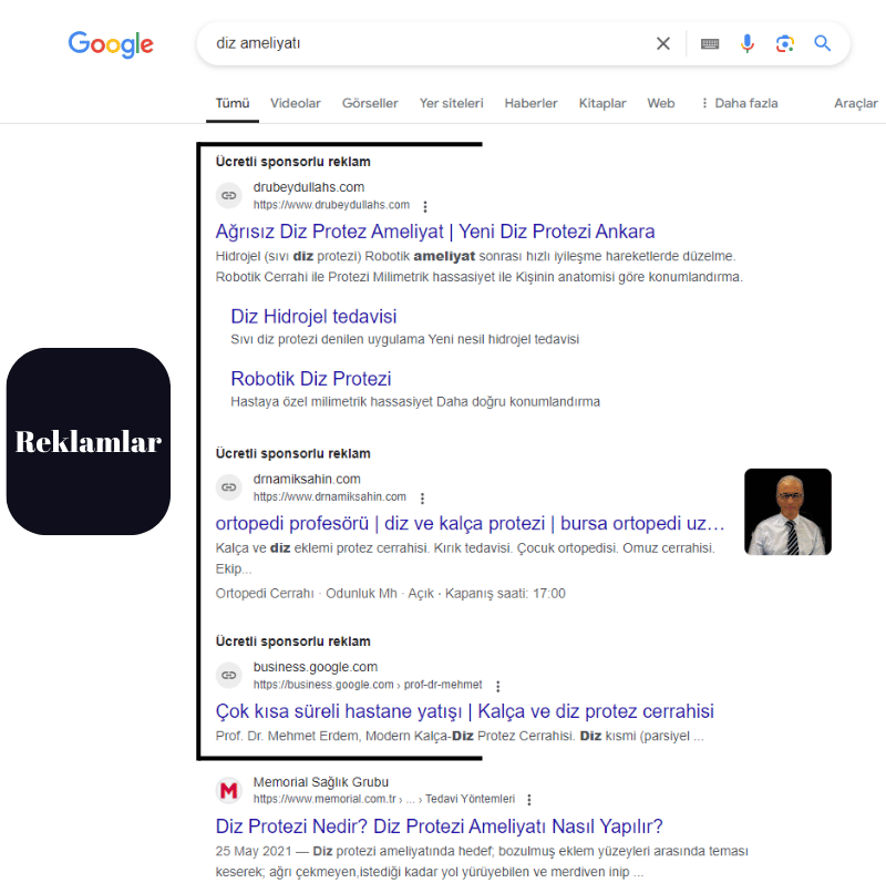 SERP Özellikleri ve Reklamlar